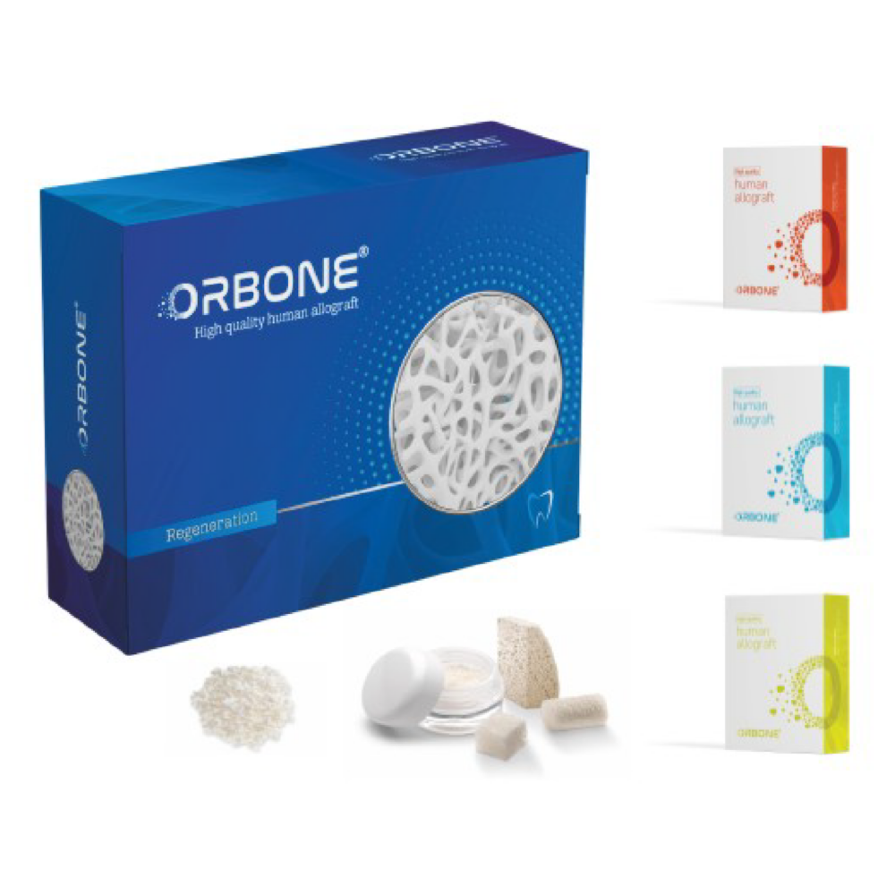 Orbone İnsan Kaynaklı Kemik Grefti